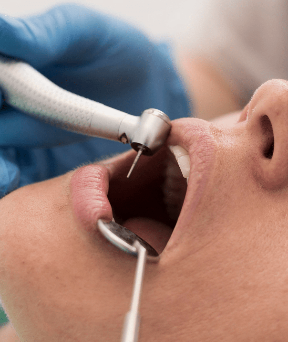 Endodoncia
