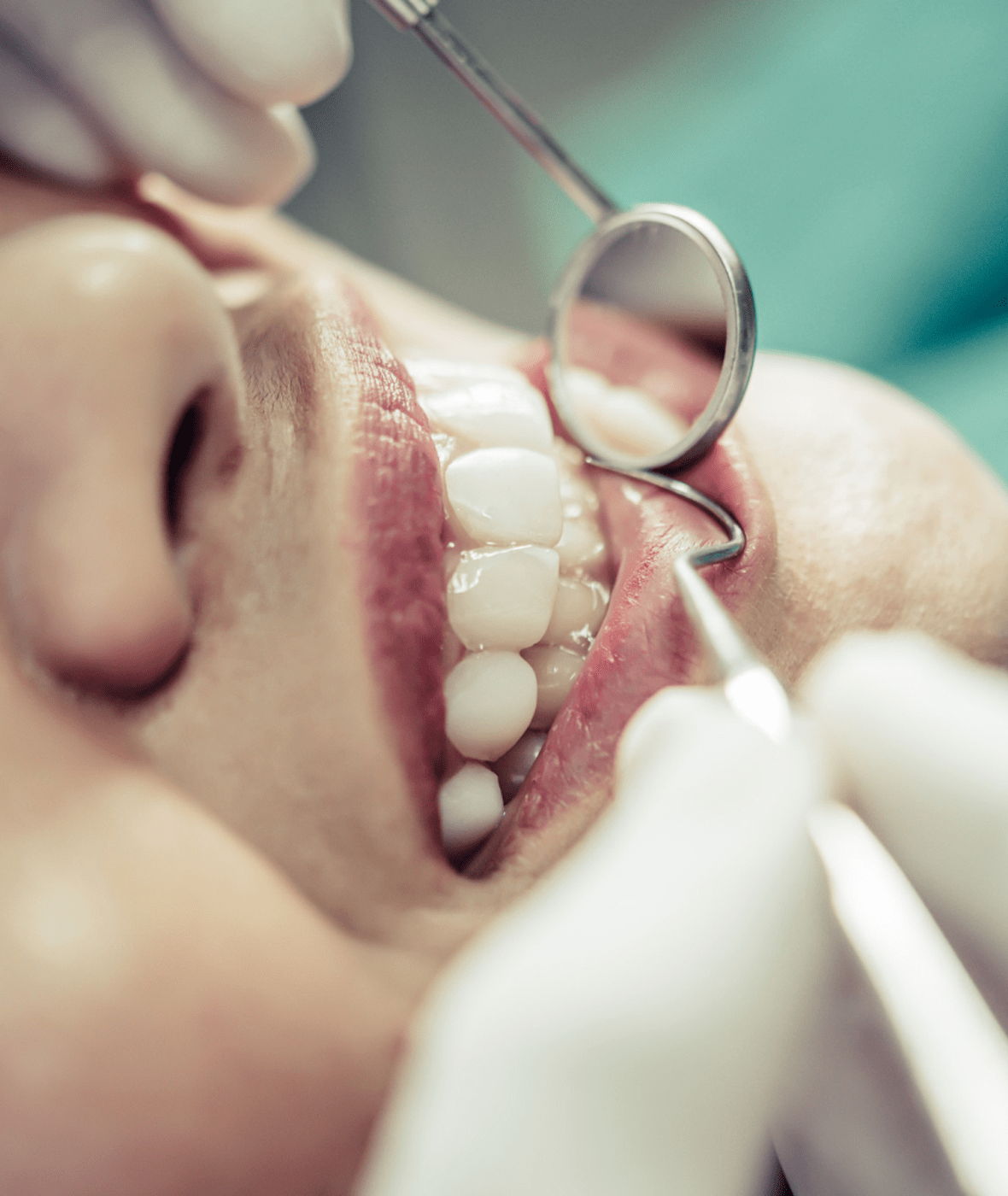 Periodoncia