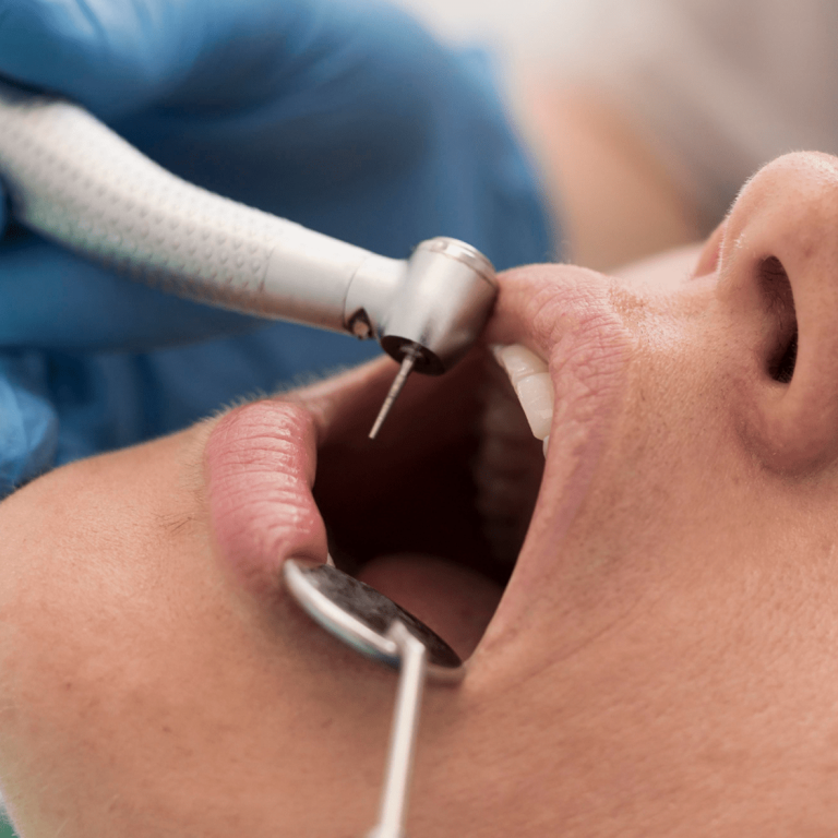 Endodoncia
