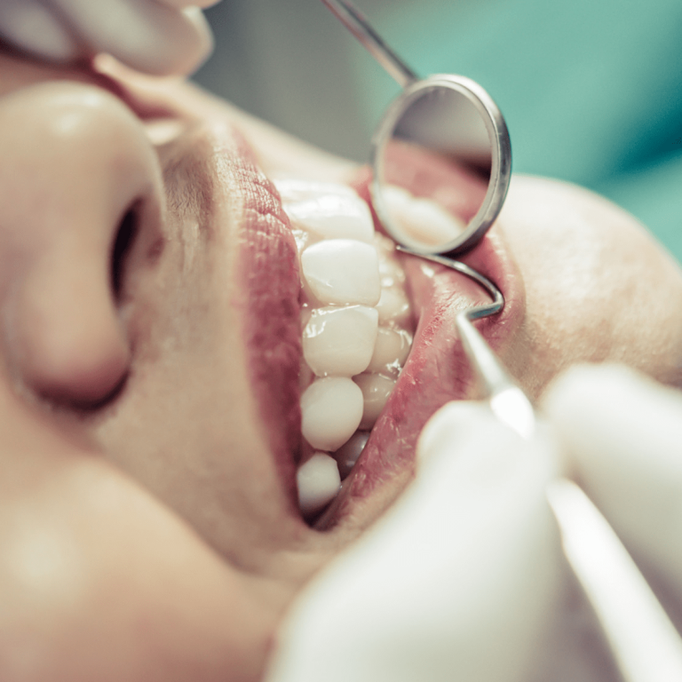 Periodoncia